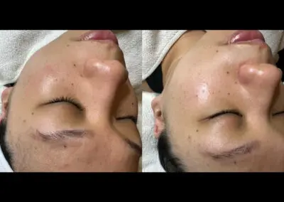 Before & After
